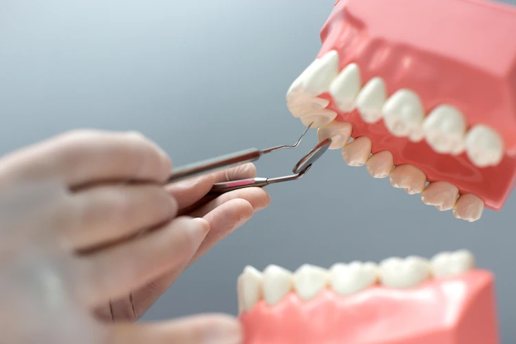 Restoring Your Smile: When Are Dental Crowns Necessary